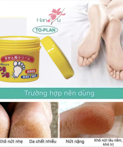 Kem Nứt Gót Chân TO-PLAN Nhật Bản – Giải Pháp Cho Gót Chân Mịn Màng