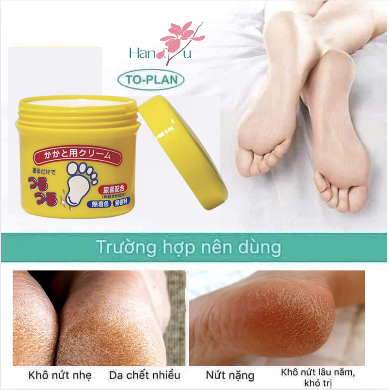 Kem Nứt Gót Chân TO-PLAN Nhật Bản – Giải Pháp Cho Gót Chân Mịn Màng